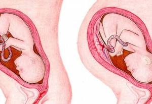 39 schwanger werden mit Fruchtbarkeit Frau